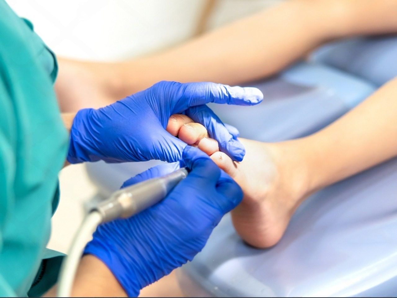 Fungal Nail Treatment
